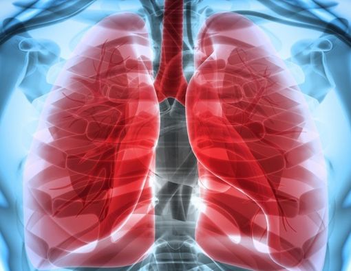 Penyakit Paru Makin Menjadi Beban