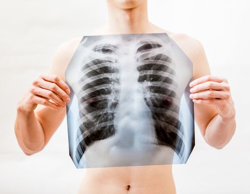 6 Pekerjaan Ini Bisa Pengaruhi Kesehatan Paru-Paru Anda